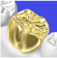 GOLDクラウン
